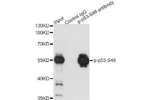 Immunoprecipitation analysis of 200 μg extracts of 293 cells both treated by UV and serum using 2. (p53 antibody  (pSer46))