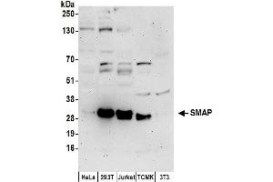 anti-Kinesin Associated Protein 3 (KIFAP3) (AA 1-50) antibody