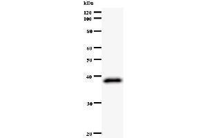 Western Blotting (WB) image for anti-Zw10 Kinetochore Protein (ZW10) antibody (ABIN933128) (ZW10 antibody)