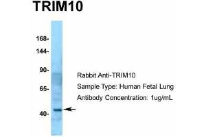 Host:  Rabbit  Target Name:  TRIM10  Sample Type:  Human Fetal Lung  Antibody Dilution:  1. (TRIM10 antibody  (C-Term))