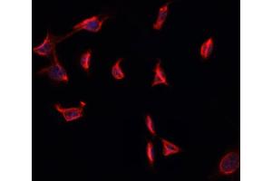 ABIN6274001 staining HepG2 cells by ICC/IF. (CD11b antibody  (Internal Region))