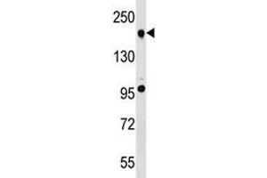 TET2 antibody western blot analysis in A549 lysate. (TET2 antibody  (AA 528-554))