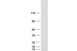 Western Blotting (WB) image for ATP/GTP Binding Protein 1 (AGTPBP1) protein (Myc-DYKDDDDK Tag) (ABIN2714468)