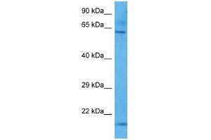 Host:  Mouse  Target Name:  KCNQ1  Sample Tissue:  Mouse Brain  Antibody Dilution:  1ug/ml (KCNQ1 antibody  (N-Term))