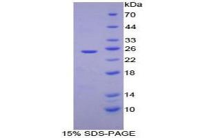 SDS-PAGE analysis of Mouse ADH1 Protein.