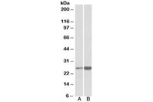 Western blot testing of human heart [A] and liver [B] lysates with Peroxiredoxin 6 antibody at 0. (Peroxiredoxin 6 antibody)