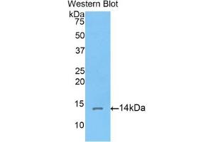 Detection of Recombinant Corin, Rat using Polyclonal Antibody to Corin (CRN) (Corin antibody  (AA 533-634))