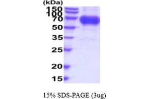 SDS-PAGE (SDS) image for Osteoactivin (GPNMB) (AA 22-474) protein (His tag) (ABIN5854811)
