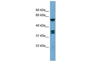 WB Suggested Anti-GRK4 Antibody Titration: 0. (GRK4 antibody  (Middle Region))