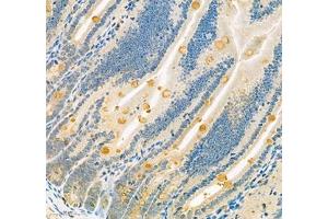 Immunohistochemistry of paraffin embedded mouse small intestine using Znt1 (ABIN7075672) at dilution of 1:650 (300x lens) (SLC30A1 antibody)