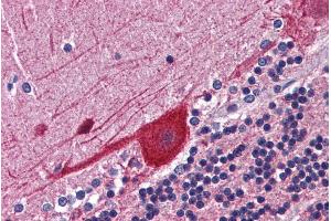 Immunohistochemistry (IHC) image for anti-FK506 Binding Protein 4, 59kDa (FKBP4) (C-Term) antibody (ABIN335136)