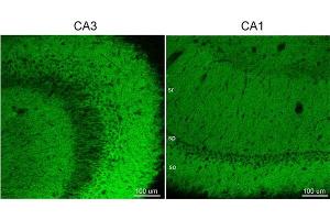 Immunohistochemistry (IHC) image for anti-gamma-aminobutyric Acid (GABA) A Receptor, alpha 5 (GABRA5) (AA 26-43) antibody (ABIN1742462)