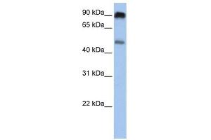 SLC45A2 antibody used at 1 ug/ml to detect target protein.