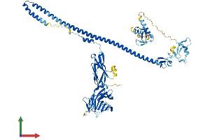 Protein Structure (PS) image for Midline 1 (MID1) (AA 1-667) protein (His tag) (ABIN7544714)