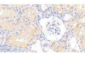 Detection of GM2A in Human Kidney Tissue using Polyclonal Antibody to GM2 Ganglioside Activator (GM2A) (GM2A antibody  (AA 24-193))