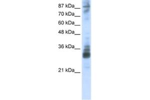 Western Blotting (WB) image for anti-RNA (Guanine-9-) Methyltransferase Domain Containing 2 (RG9MTD2) antibody (ABIN2462341) (RG9MTD2 antibody)