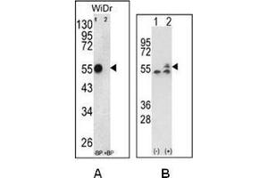 A: Western blot analysis of ATP5B Antibody (Center) Cat. (ATP Synthase Subunit beta (AtpB) (AA 142-171), (Middle Region), (Subunit beta) antibody)