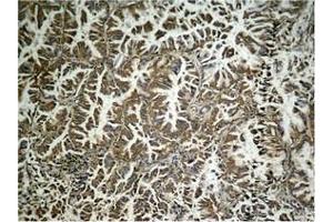 Immunohistochemistry (IHC) image for anti-Eukaryotic Translation Initiation Factor 2 Subunit 1 (EIF2S1) (pSer49) antibody (ABIN7138634)