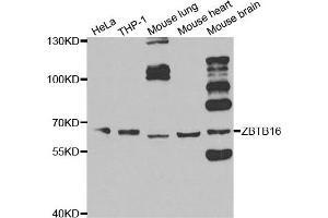 Western blot analysis of extracts of various cell lines, using ZBTB16 antibody. (ZBTB16 antibody)