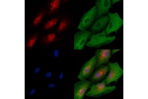 ABIN6264710 and ABIN6278515 staining  cells by IF/ICC.