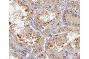 ABIN6266579 at 1/200 staining human kidney tissue sections by IHC-P. (NOS2 antibody  (C-Term))