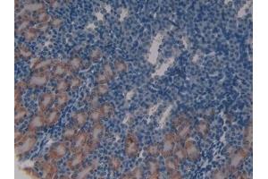Detection of ATM in Mouse Kidney Tissue using Polyclonal Antibody to Ataxia Telangiectasia Mutated (ATM) (ATM antibody  (AA 486-742))