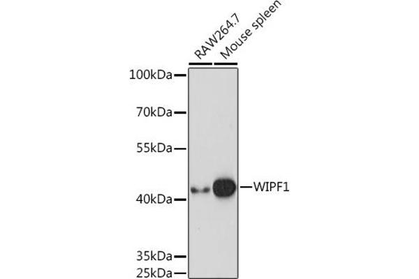 WIPF1 antibody  (AA 400-500)