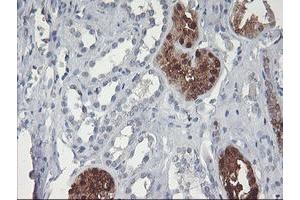 Immunohistochemical staining of paraffin-embedded Human Kidney tissue using anti-GBA3 mouse monoclonal antibody. (GBA3 antibody  (AA 1-150, AA 370-469))