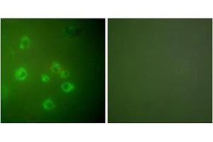 Immunofluorescence analysis of COS7 cells, using GRP78 antibody (ABIN5976417). (GRP78 antibody  (C-Term))