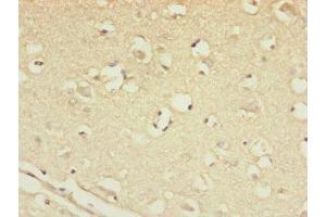 Immunohistochemistry of paraffin-embedded human brain tissue using ABIN7147450 at dilution of 1:100 (CSPP1 antibody  (AA 997-1256))