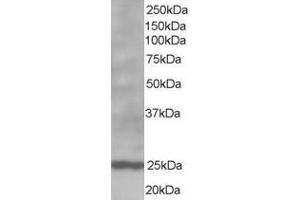 ABIN185269 staining (1µg/ml) of Human Lymph Node lysate (RIPA buffer, 35µg total protein per lane).