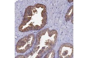Immunohistochemical staining of human prostate with TOMM20L polyclonal antibody  shows strong cytoplasmic positivity in glandular cells. (TOMM20L antibody)