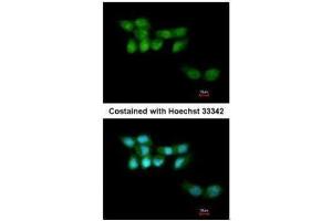 ICC/IF Image Immunofluorescence analysis of paraformaldehyde-fixed A431, using UVSSA antibody [N1N2], N-term , at 1:200 dilution. (UVSSA/KIAA1530 antibody  (N-Term))