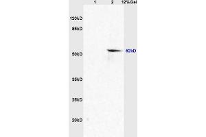 Lane 1: mouse embryo lysates Lane 2: mouse brain lysates probed with Anti AVPR2 Polyclonal Antibody, Unconjugated (ABIN705746) at 1:200 in 4 °C. (SLC2A8 antibody  (AA 401-477))