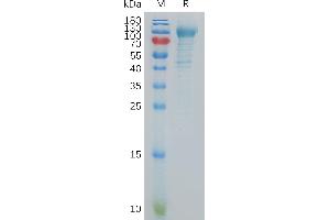 K-Cadherin (CDH6) (AA 19-615) protein (His tag)