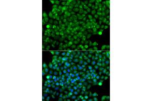 Immunofluorescence analysis of A549 cell using CFHR3 antibody. (CFHR3 antibody)