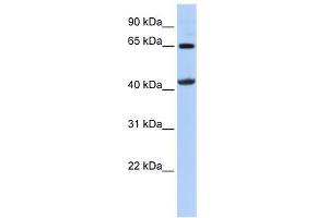 GATM antibody used at 1 ug/ml to detect target protein.