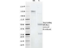 SDS-PAGE Analysis Purified CD6 Mouse Monoclonal Antibody (C6/372).