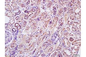 Formalin-fixed and paraffin embedded human kidney labeled with Anti-Arginase II Polyclonal Antibody, Unconjugated  at 1:200 followed by conjugation to the secondary antibody and DAB staining (ARG2 antibody  (AA 181-290))