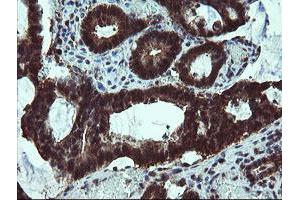 Image no. 2 for anti-Tubulin Folding Cofactor C (TBCC) antibody (ABIN1501323) (TBCC antibody)