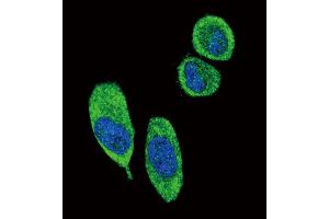 Confocal immunofluorescent analysis of SFN Antibody (C-term)  with A549 cell followed by Alexa Fluor? (14-3-3 sigma/SFN antibody  (C-Term))