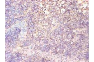 Immunohistochemical of paraffin-embedded human lymph node tissue using ABIN7152718 at dilution of 1:200 (FTL antibody)