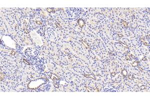 Detection of LDHB in Human Kidney Tissue using Polyclonal Antibody to Lactate Dehydrogenase B (LDHB) (LDHB antibody  (AA 1-334))