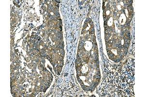 IHC analysis of RAB13 using anti-RAB13 antibody (ABIN7600599).