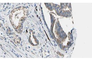 ABIN6277641 at 1/100 staining Human prostate tissue by IHC-P. (ATIC antibody  (C-Term))