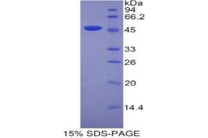 SDS-PAGE analysis of Mouse Lipocalin 4 Protein.