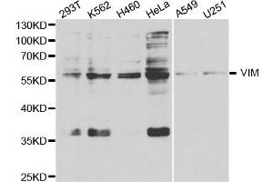 Western Blotting (WB) image for anti-Vimentin (VIM) antibody (ABIN1875329) (Vimentin antibody)