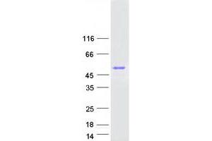 Validation with Western Blot