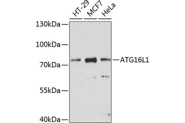 ATG16L1 抗体  (AA 200-300)