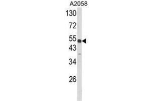 Western blot analysis of ANXA7 Antibody (Center) in A2058 cell line lysates (35ug/lane). (Annexin VII antibody  (Middle Region))